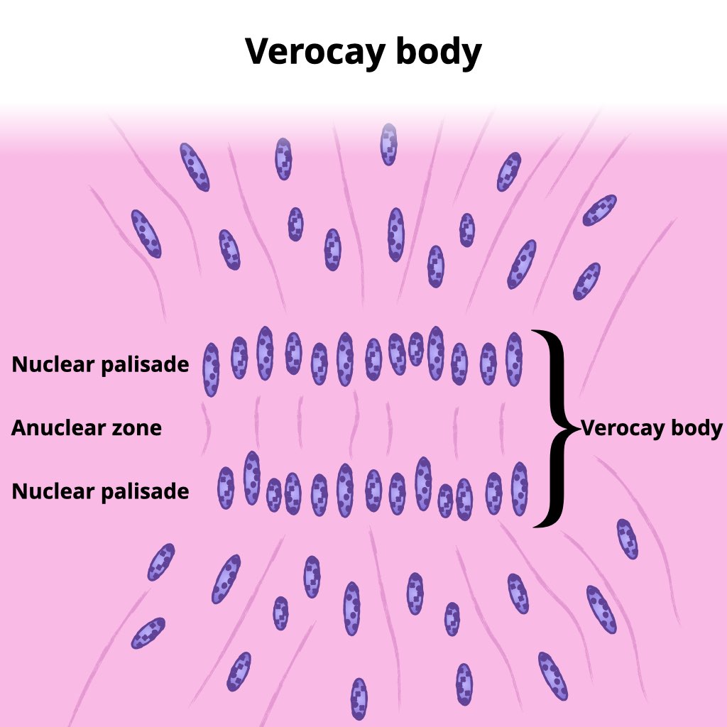 Image | Radiopaedia.org