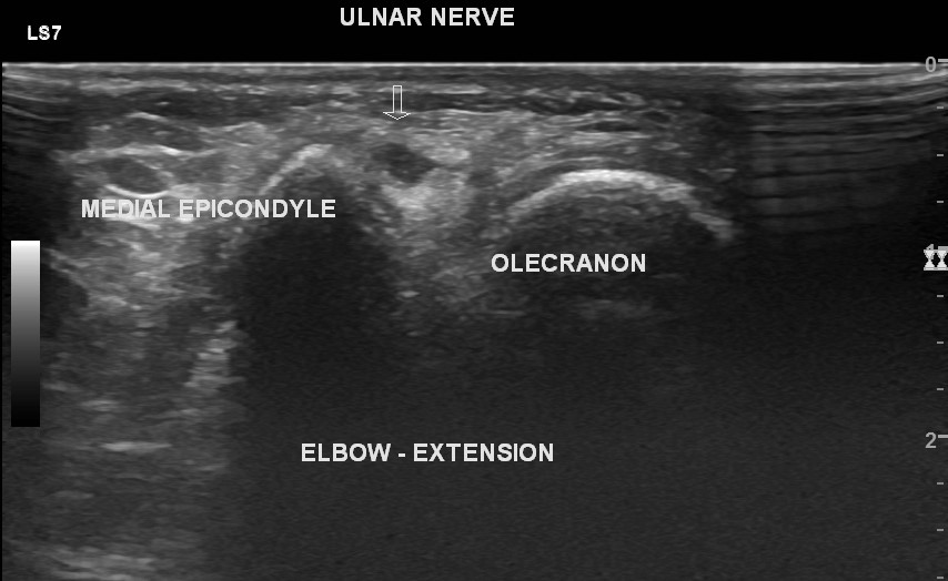 Image | Radiopaedia.org