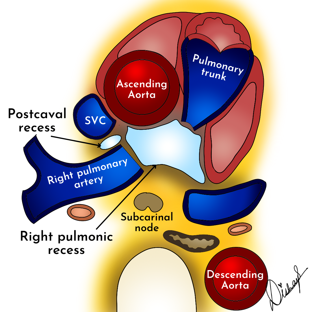 Image | Radiopaedia.org