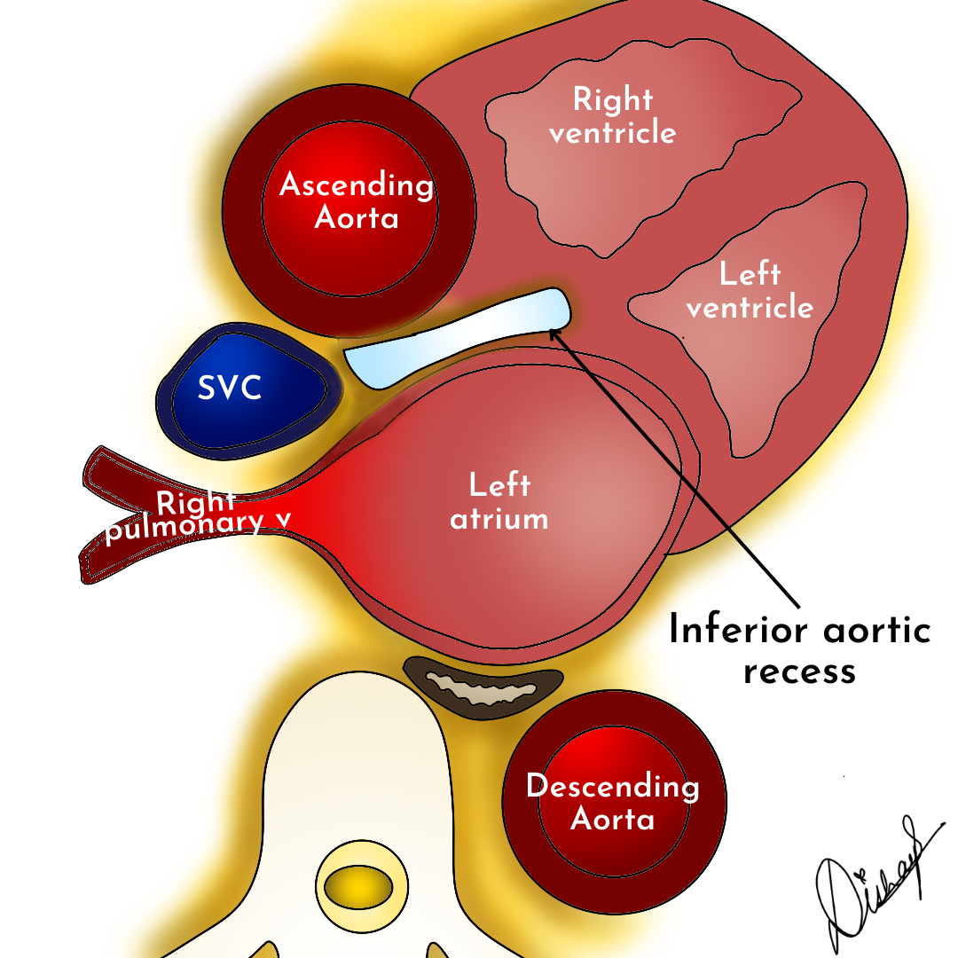 Image | Radiopaedia.org