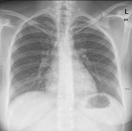 Radiology Quiz 166563 | Radiopaedia.org