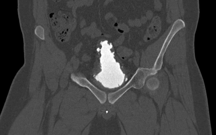 Radiology Quiz 166890 | Radiopaedia.org