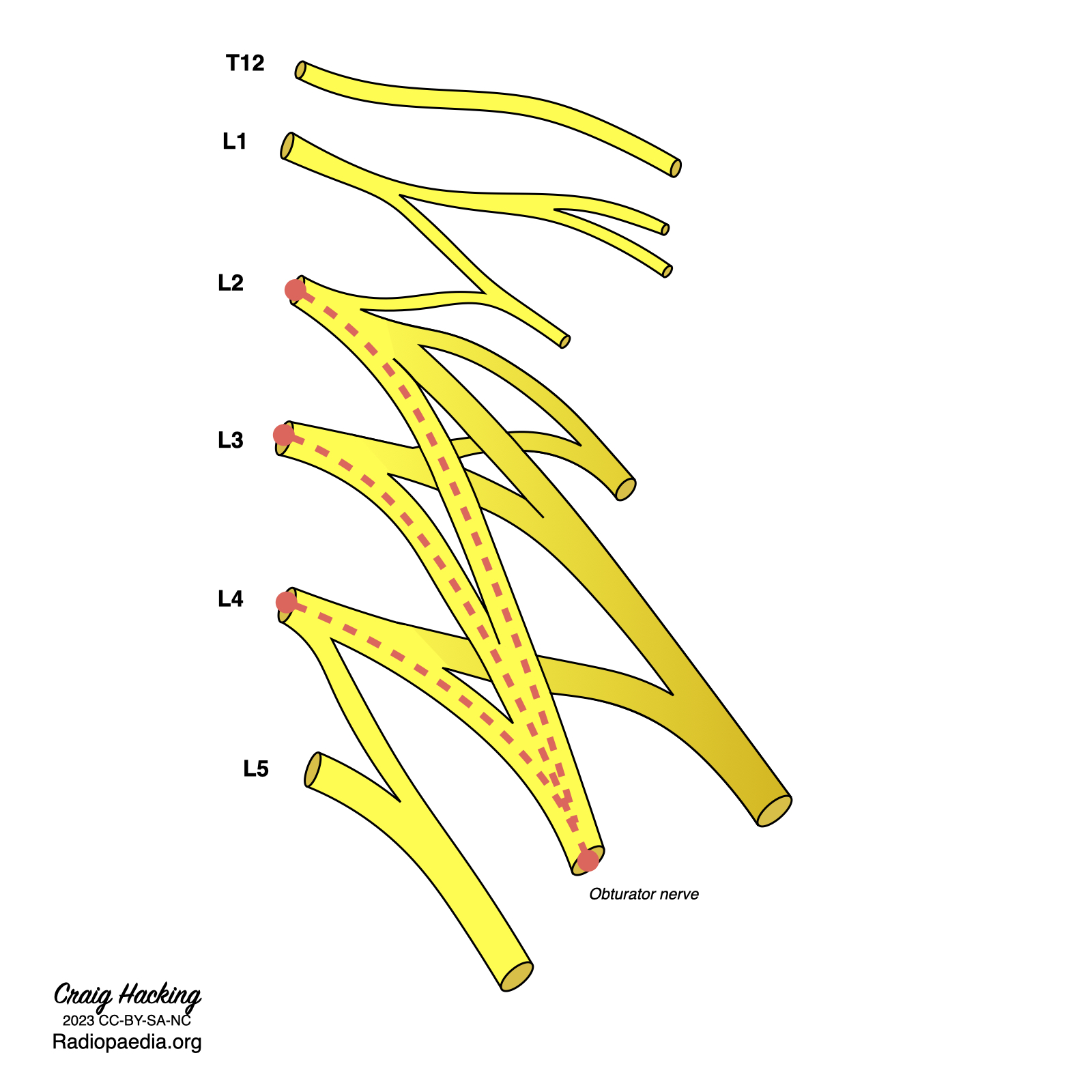 Image | Radiopaedia.org