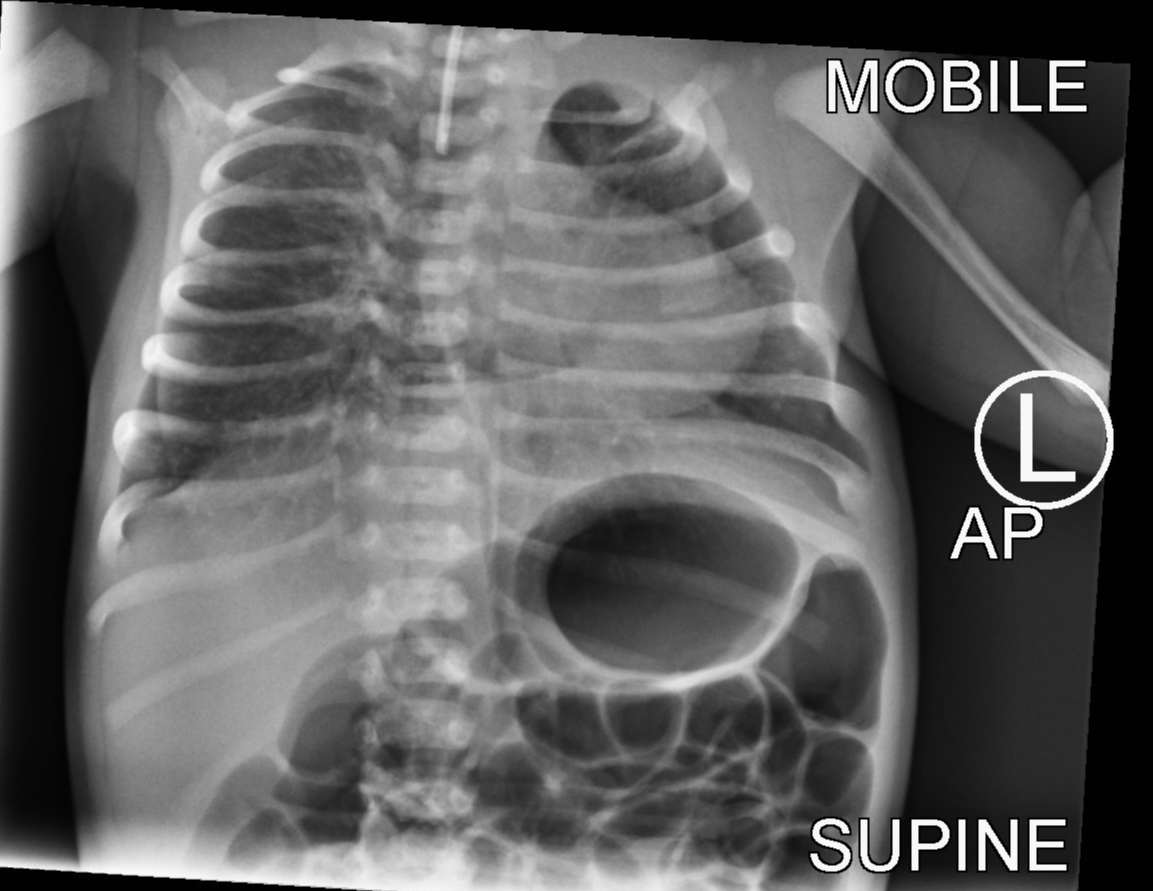 Radiology Quiz 164221 | Radiopaedia.org