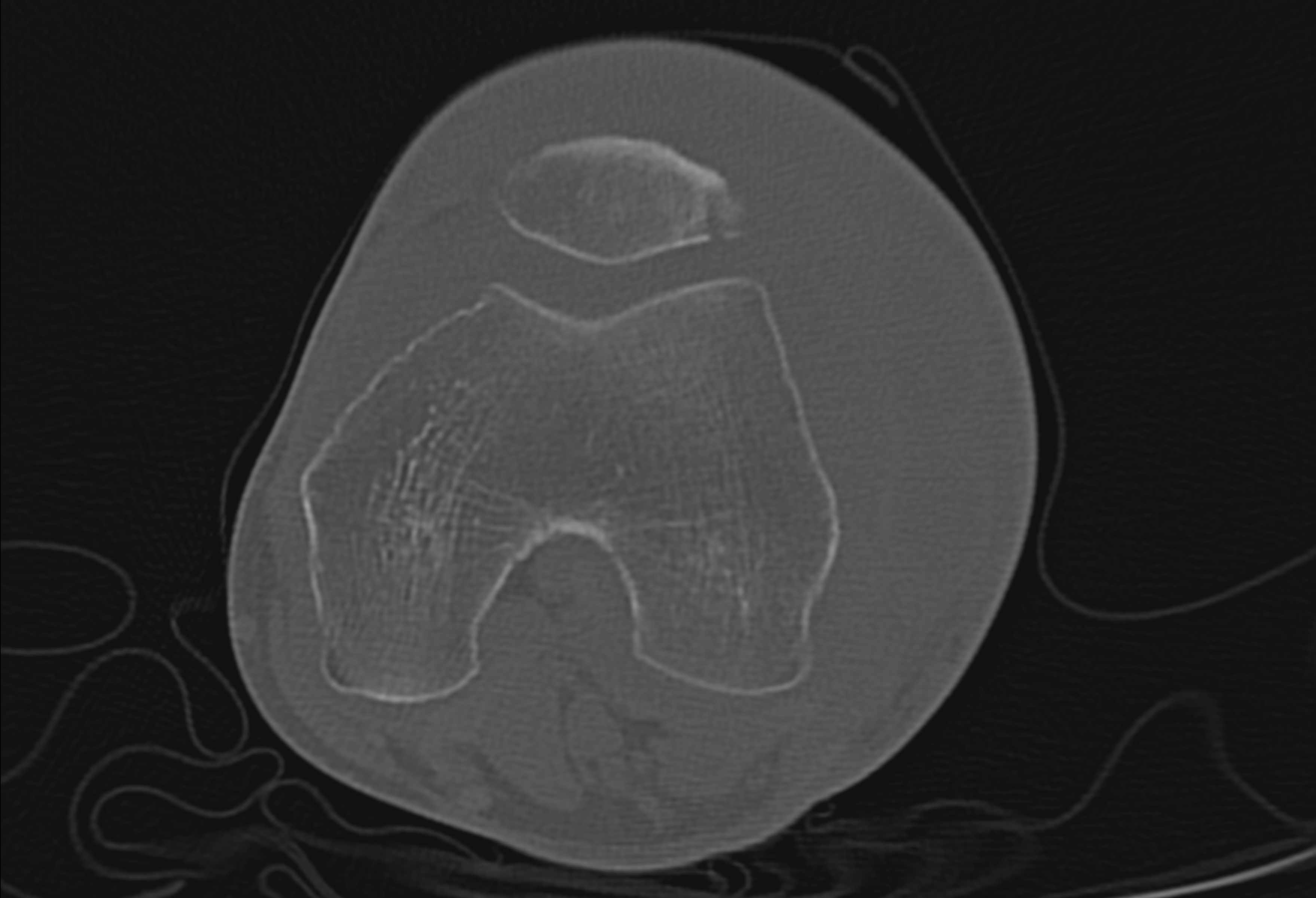 Radiology Quiz 167180 | Radiopaedia.org