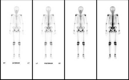 Image | Radiopaedia.org