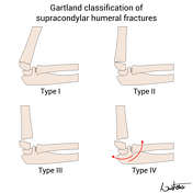 Cases | System: Paediatrics | Radiopaedia.org