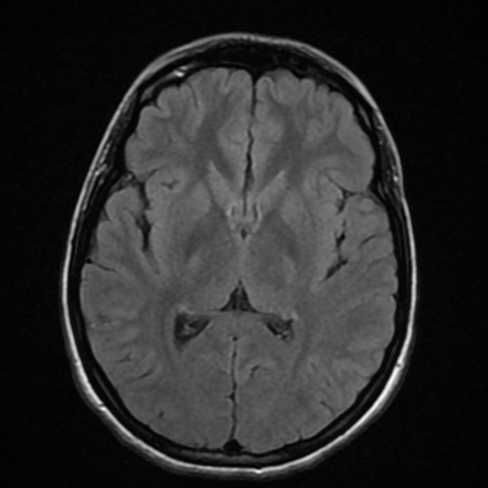 Viewing playlist: Head&neck | Radiopaedia.org