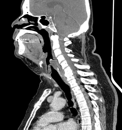 Viewing playlist: Head & Neck | Radiopaedia.org