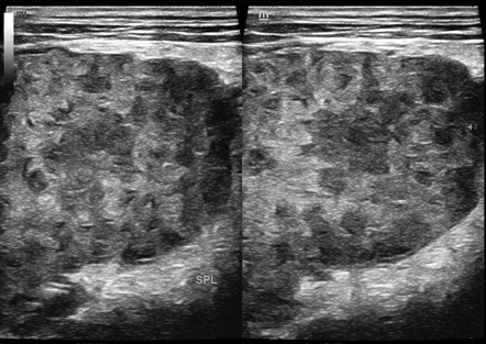 Radiology Quiz 168883 | Radiopaedia.org