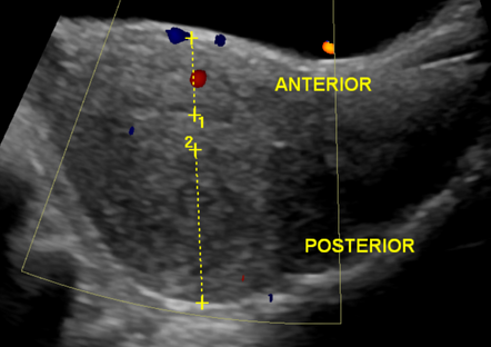 Image | Radiopaedia.org