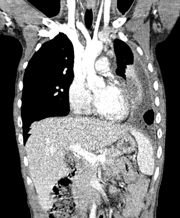 Radiology Quiz 169346 | Radiopaedia.org