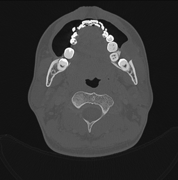 Radiology Quiz 169788 | Radiopaedia.org