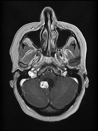 Radiology Quiz 170119 | Radiopaedia.org