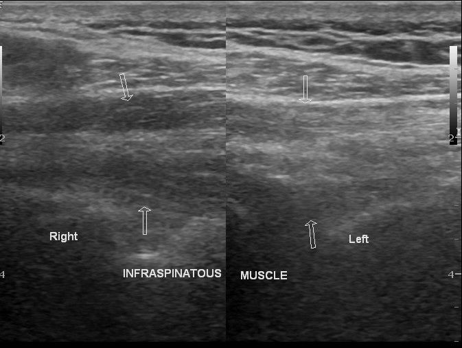 Image | Radiopaedia.org