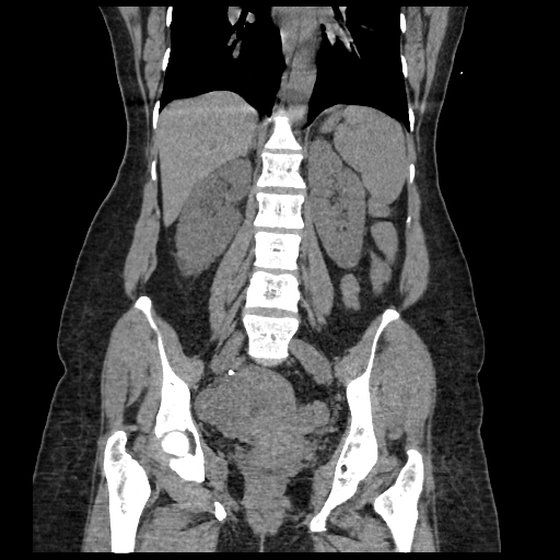 image-radiopaedia