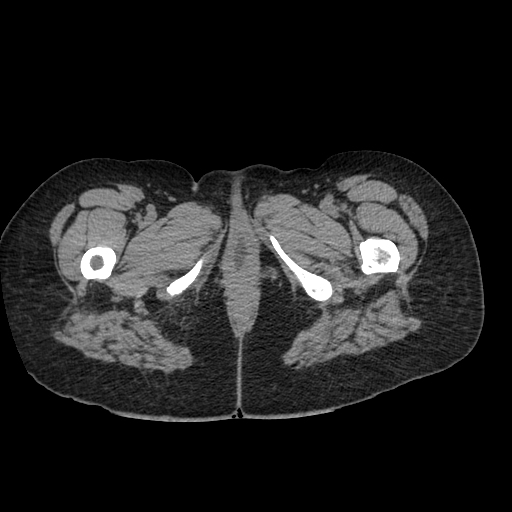 image-radiopaedia