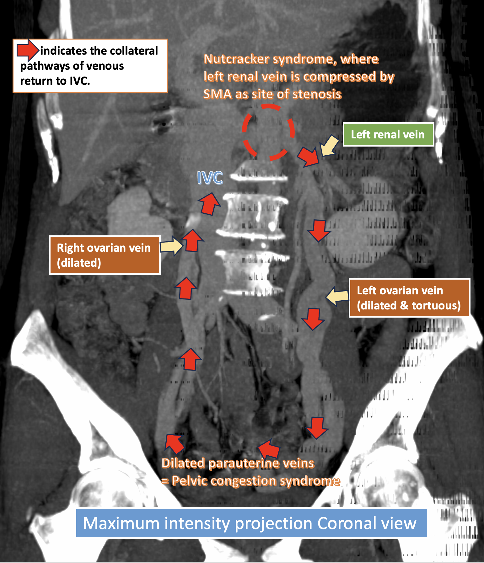 Image | Radiopaedia.org