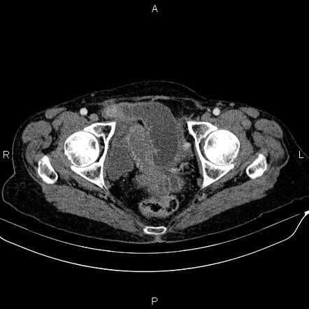 Image | Radiopaedia.org