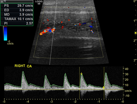 Image | Radiopaedia.org