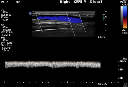 Image | Radiopaedia.org