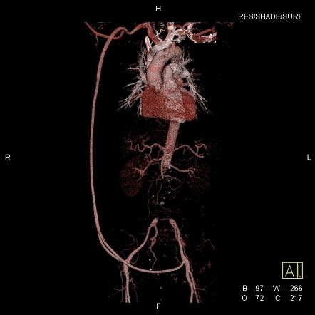 Viewing Playlist: Vasc/Int 1 | Radiopaedia.org