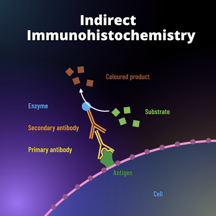 Immunohistochemistry | Radiology Reference Article | Radiopaedia.org