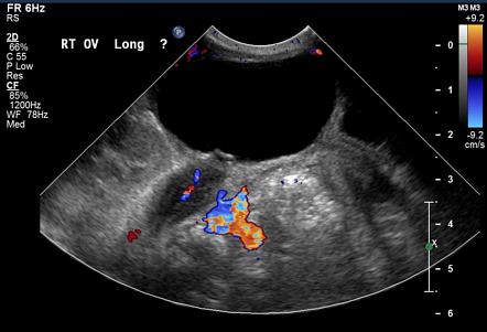 Image | Radiopaedia.org