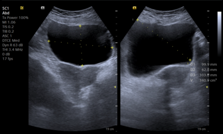 Image | Radiopaedia.org