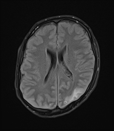 Radiology Quiz 173403 | Radiopaedia.org