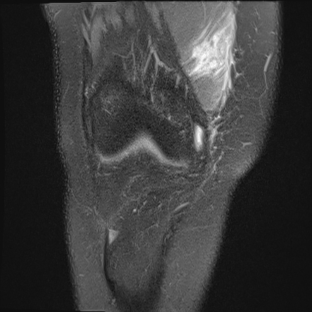 Radiology Quiz 173539 Radiopaedia Org