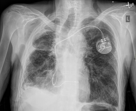 Radiology Quiz 173940 | Radiopaedia.org