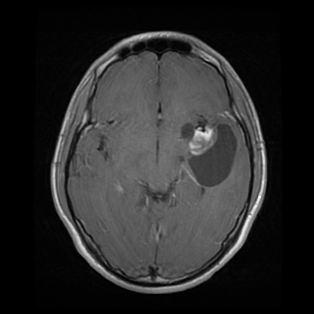 Radiology Quiz 174475 | Radiopaedia.org