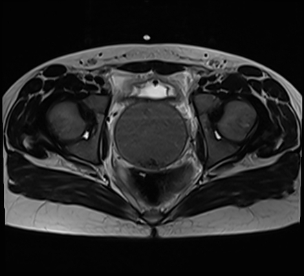 Images | Radiopaedia.org