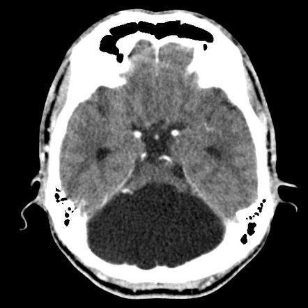 Radiopaedia.org, the peer-reviewed collaborative radiology resource