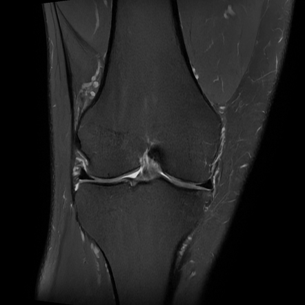 Images Radiopaedia Org