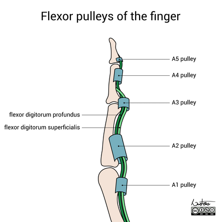 Flexor pulleys of the finger - anatomy | Radiology Case | Radiopaedia.org