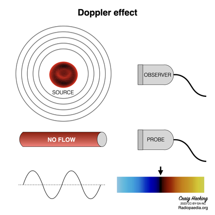 Ultrasound imaging in B-mode, color and spectral Doppler of the