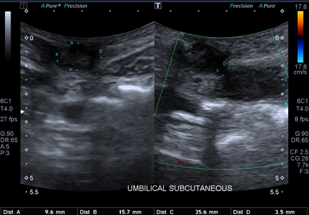 Image | Radiopaedia.org