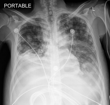 Images | Radiopaedia.org