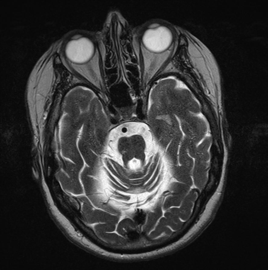 Radiology Quiz 28472 | Radiopaedia.org