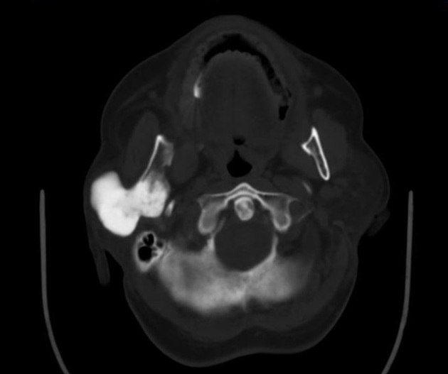 Images | Radiopaedia.org