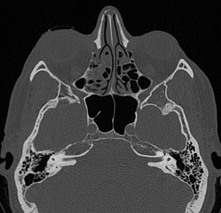 Image | Radiopaedia.org