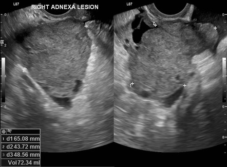 Radiology Quiz 182842 | Radiopaedia.org