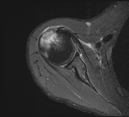 Images | Radiopaedia.org