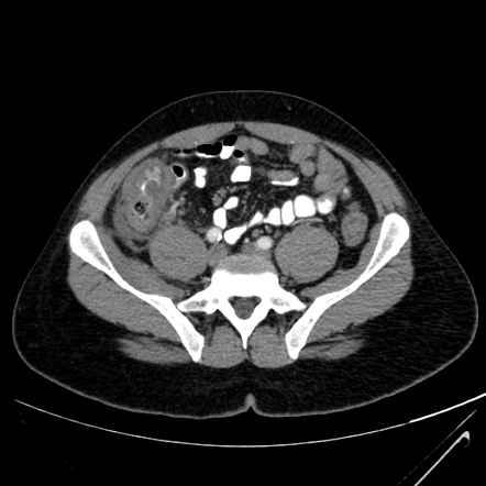 Images | Radiopaedia.org