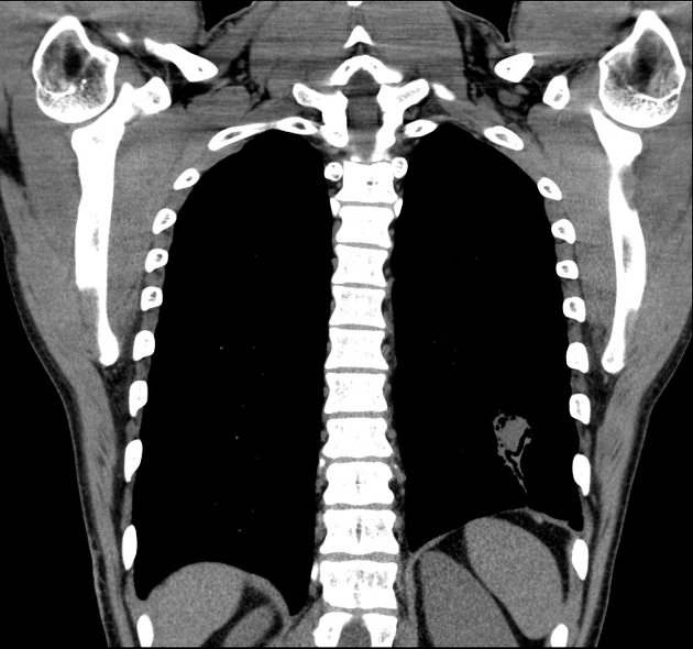 Images | Radiopaedia.org