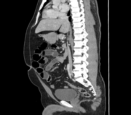 Images | Radiopaedia.org