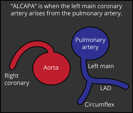 Image | Radiopaedia.org