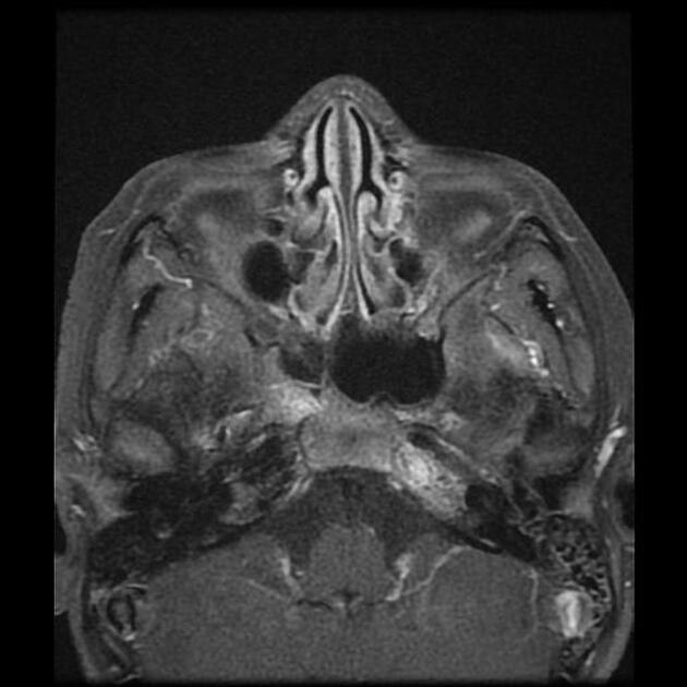 Images | Radiopaedia.org